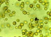 Zooxanthellae